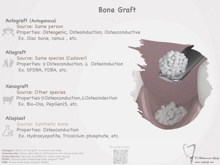 Bone graft