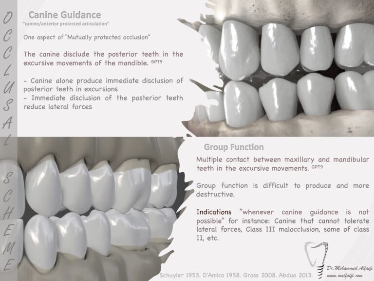 Occlusal scheme