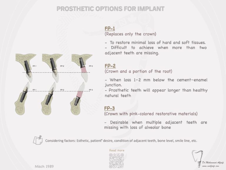 Prosthetic